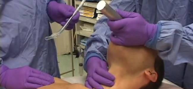 Own the airway part 4: Laryngoscopy