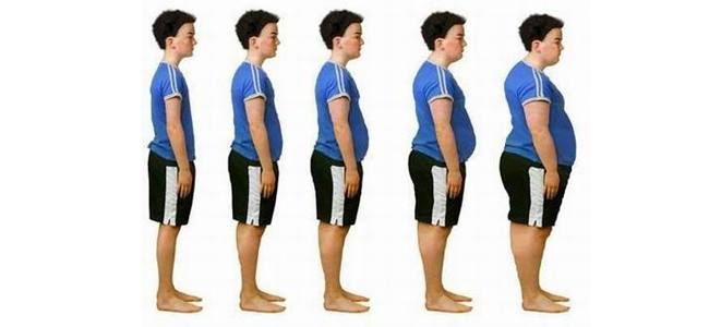 Is sugar causing the obesity ‘epidemic’?
