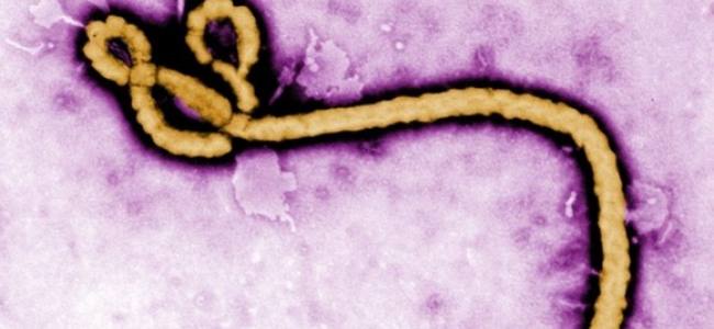 Ebola treatment centre for pregnant women opens