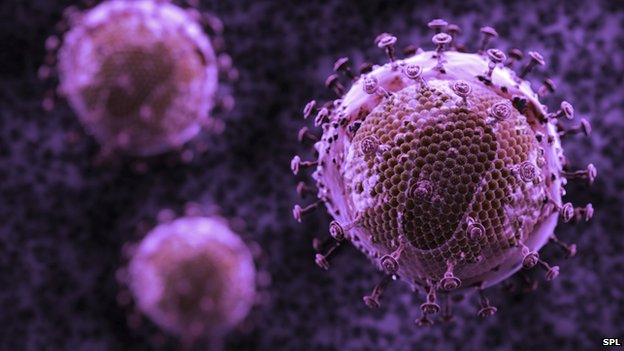 HIV evolving ‘into milder form’