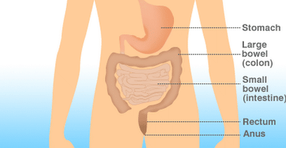 Wales’ bowel surgery death rate ‘higher than expected’