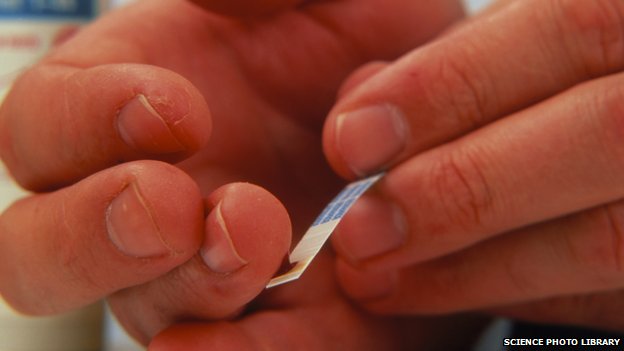 Poor diabetes care in England ‘costing lives’