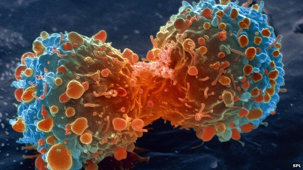 Most cancer types ‘just bad luck