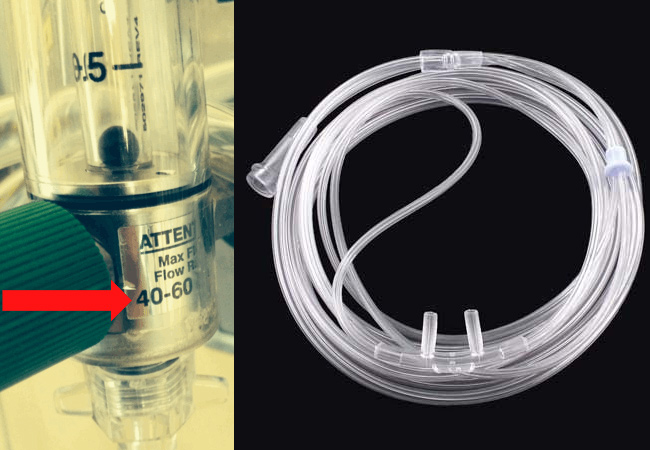 Nasal Cannula for Preoxygenation & Apneic Oxygenation: How to do it