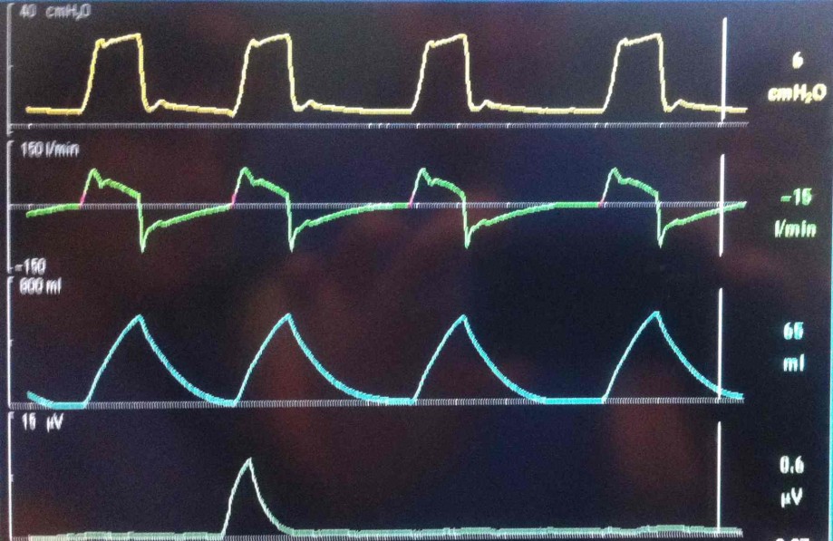 Hemodynamic Assessment in the Emergency Department
