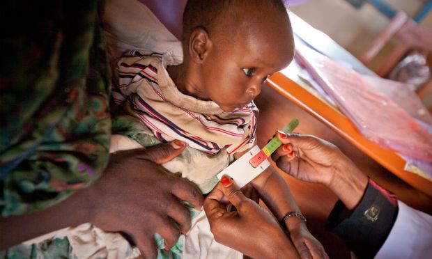 An estimated 14,000 children suffering from severe acute malnutrition