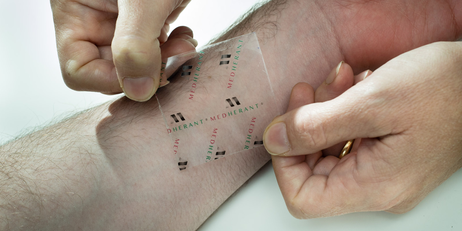 Ibuprofen Patch, a new idea that can reduce Pain for 12 Hours