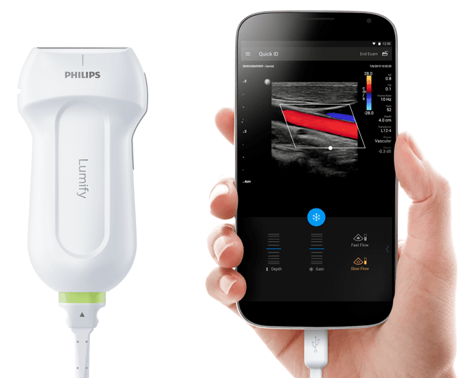 Philips Lumify, benefits of ultrasound extended to more places than ever
