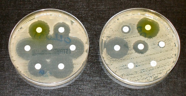 Antimicrobial resistance, the O’Neill’s review is a a wake-up call for the world
