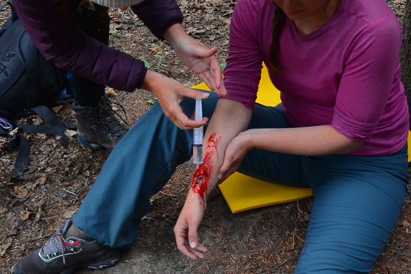 3 most commom mistakes on wound treatment that cause more HARM than good