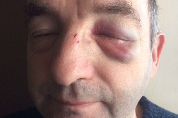 Assaulting paramedics in UK is not punished with jail – “This unjustice must be stopped”