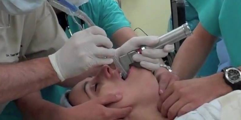 From ScanCrit: Intubation in arrest – again