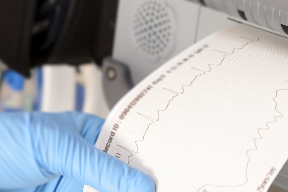 Linee guida per la diagnosi e la terapia della fibrillazione atriale [Open Access] | Emergency Live 