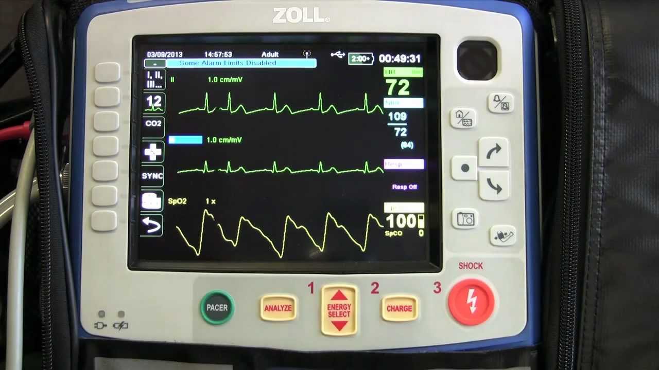 Trasmissione ECG: si, ma con che cosa? | Emergency Live 18