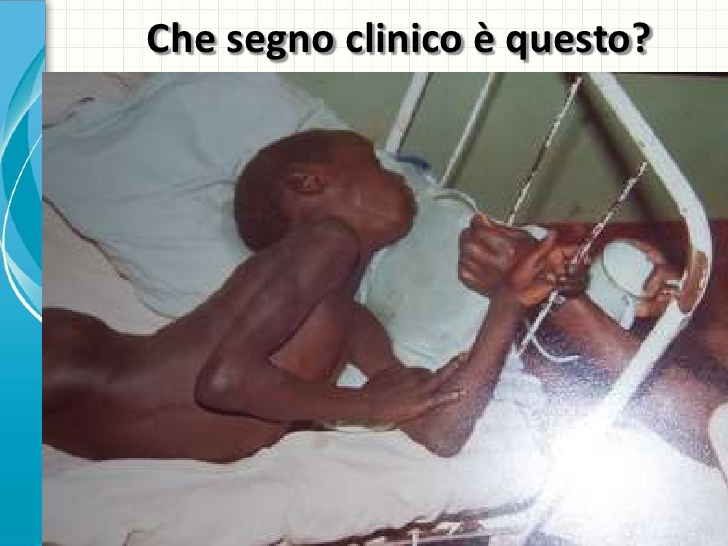 Bambini, vaccini e obblighi del medico: quando e come si può superare la volontà dei genitori? | Emergency Live 2