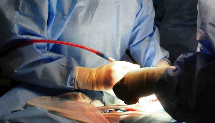 Circoncisione: in cosa consiste, questa pratica chirurgica? | Emergency Live