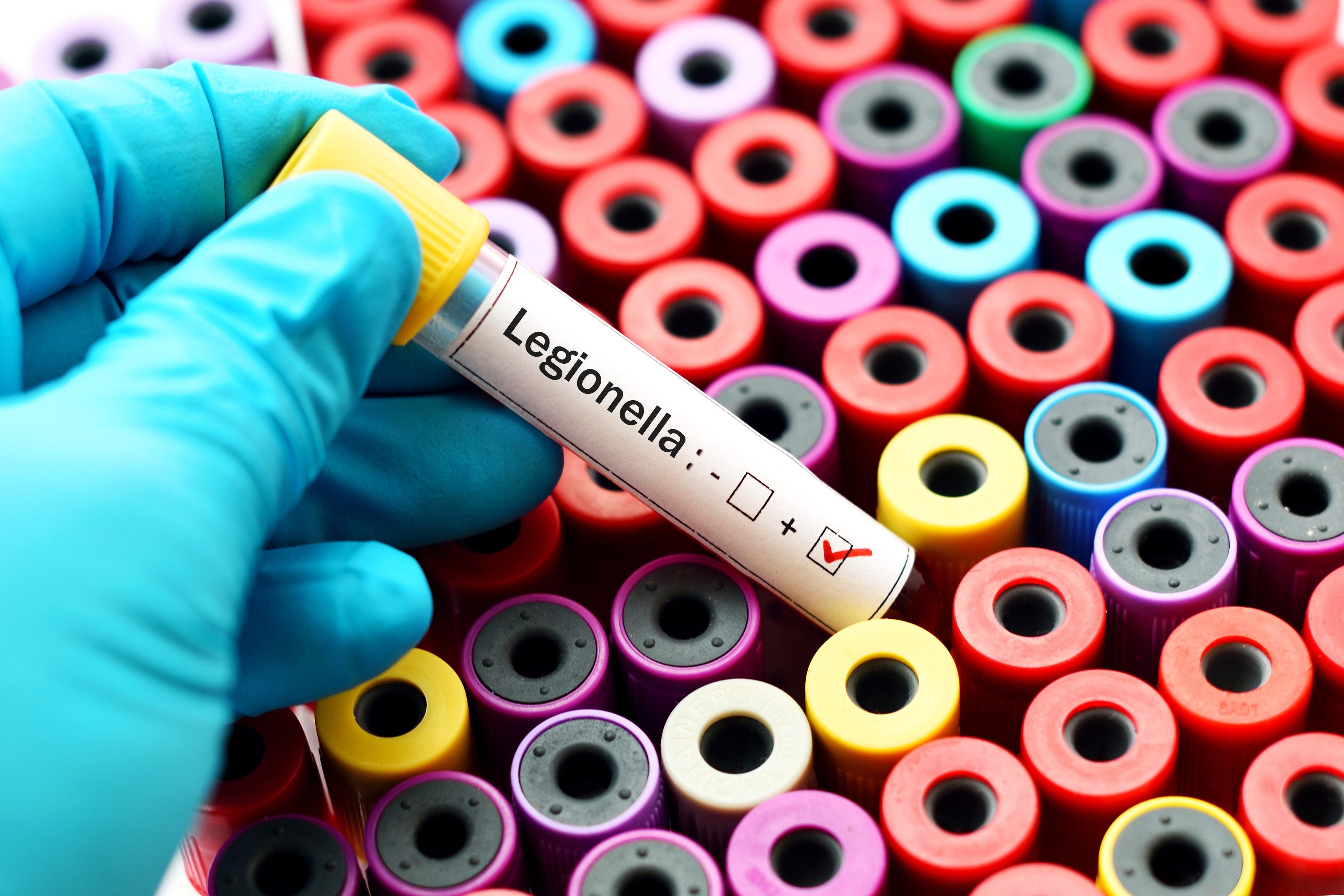 Legionella, quello che c'è da sapere | Emergency Live 5