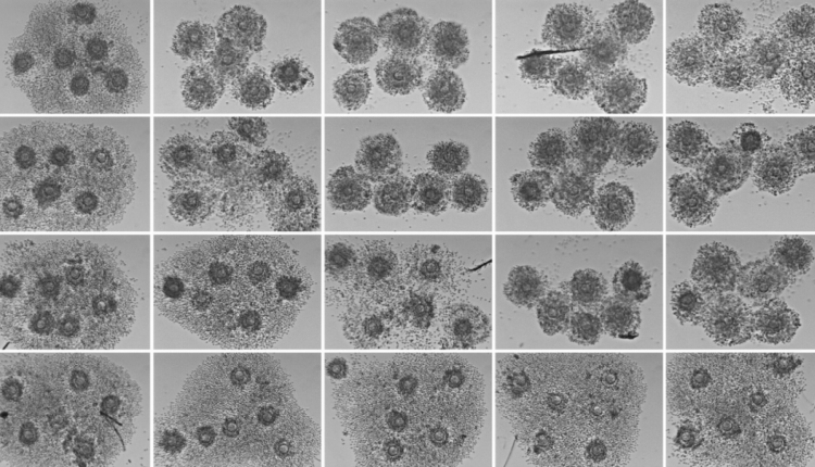 Coronavirus, a quando il picco di contagio? Non è da escludere metà aprile, anzi! | Emergency Live