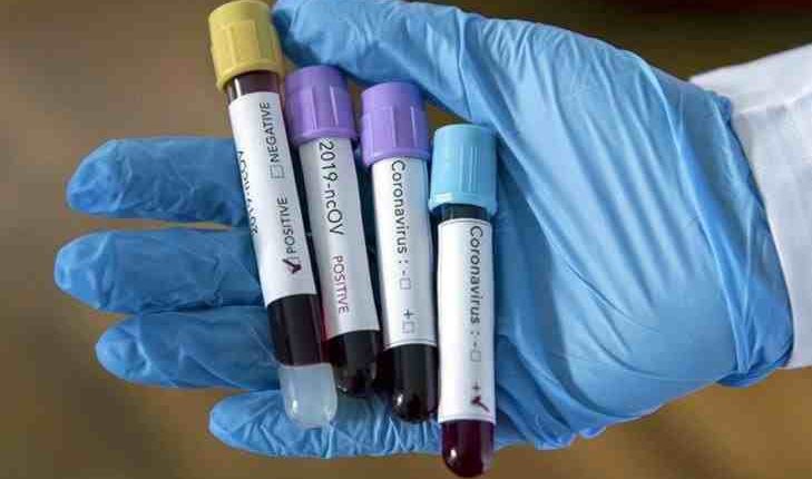 Plasmaterapia nella terapia per il Covid-19: la John Hopkins University pubblica una guida per gli ospedali | Emergency Live