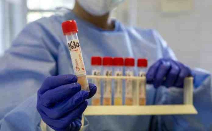 Coronavirus, nel 73% dei soggetti negativizzati il virus permane nelle feci | Emergency Live