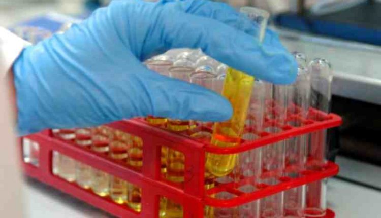 Vaccino per il coronavirus, su America first la francese Sanofi fa un passo indietro | Emergency Live