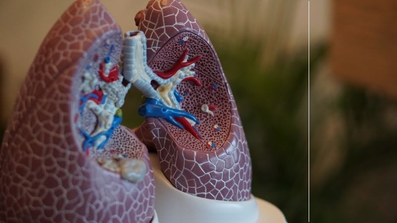 Carcinoma polmonare e tiroideo: negli USA l’FDA approva il trattamento con Retevmo | Emergency Live