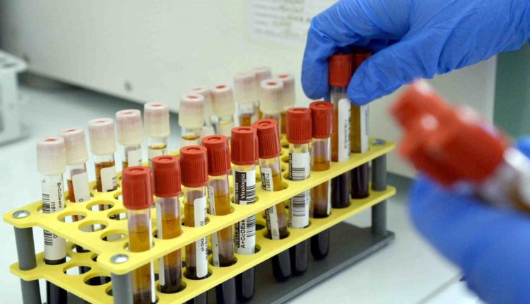 Coronavirus, confermato il trend positivo: 262 i nuovi casi e 49 morti | Emergency Live