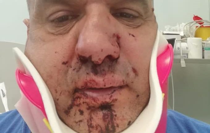Il DDL aggressioni ai soccorritori è legge. Ma anche oggi sono stati minacciati con coltello e presi a pugni | Emergency Live 1