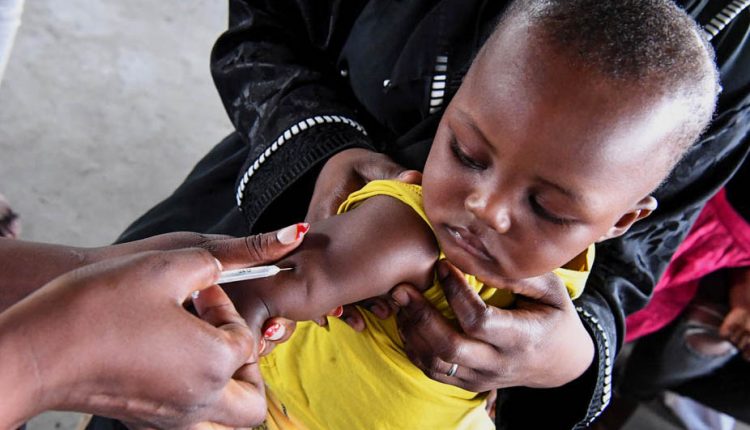 Camerun, epidemia di morbillo: finora oltre 1.400 casi confermati in otto regioni, con 13 decessi già registrati | Emergency Live