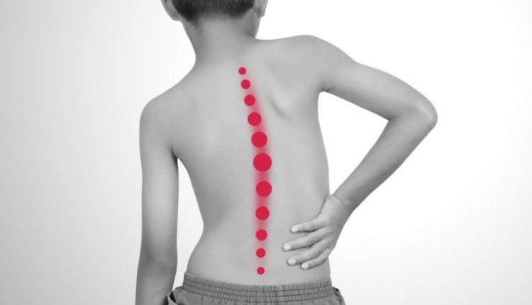 Società italiana di Ortopedia e Traumatologia: scoliosi, ginocchia a X e piede piatto patologie piu' comuni nei bambini | Emergency Live