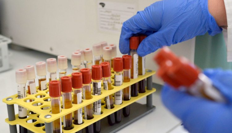 Plasma iperimmune, o convalescente, The New England Journal: “Nessun effetto significativo sui pazienti” | Emergency Live