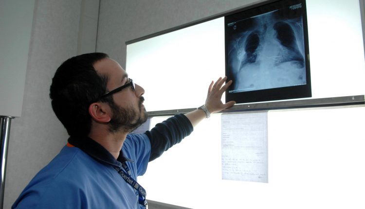 COVID-19, Cineca: “Nel 2019 troppe polmoniti, con un database nazionale avremmo dato l’allarme” | Emergency Live