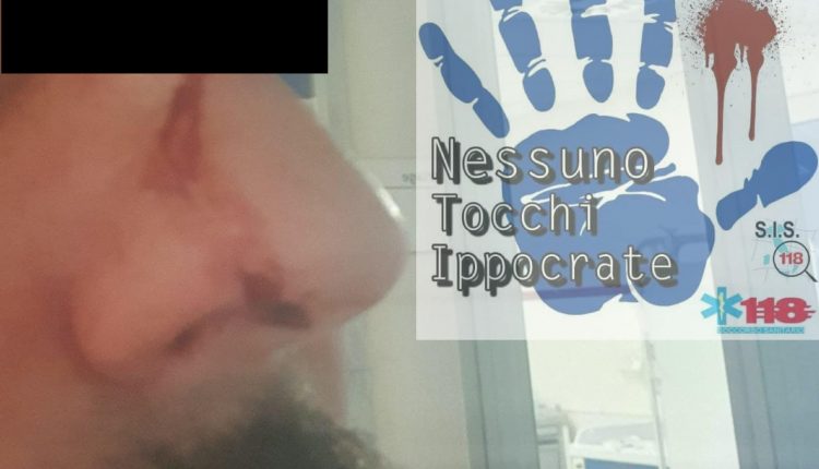 Ambulanza con paziente a bordo: “Se mi vieni addosso ti sparo!”. Autista soccorritore preso a pugni 1