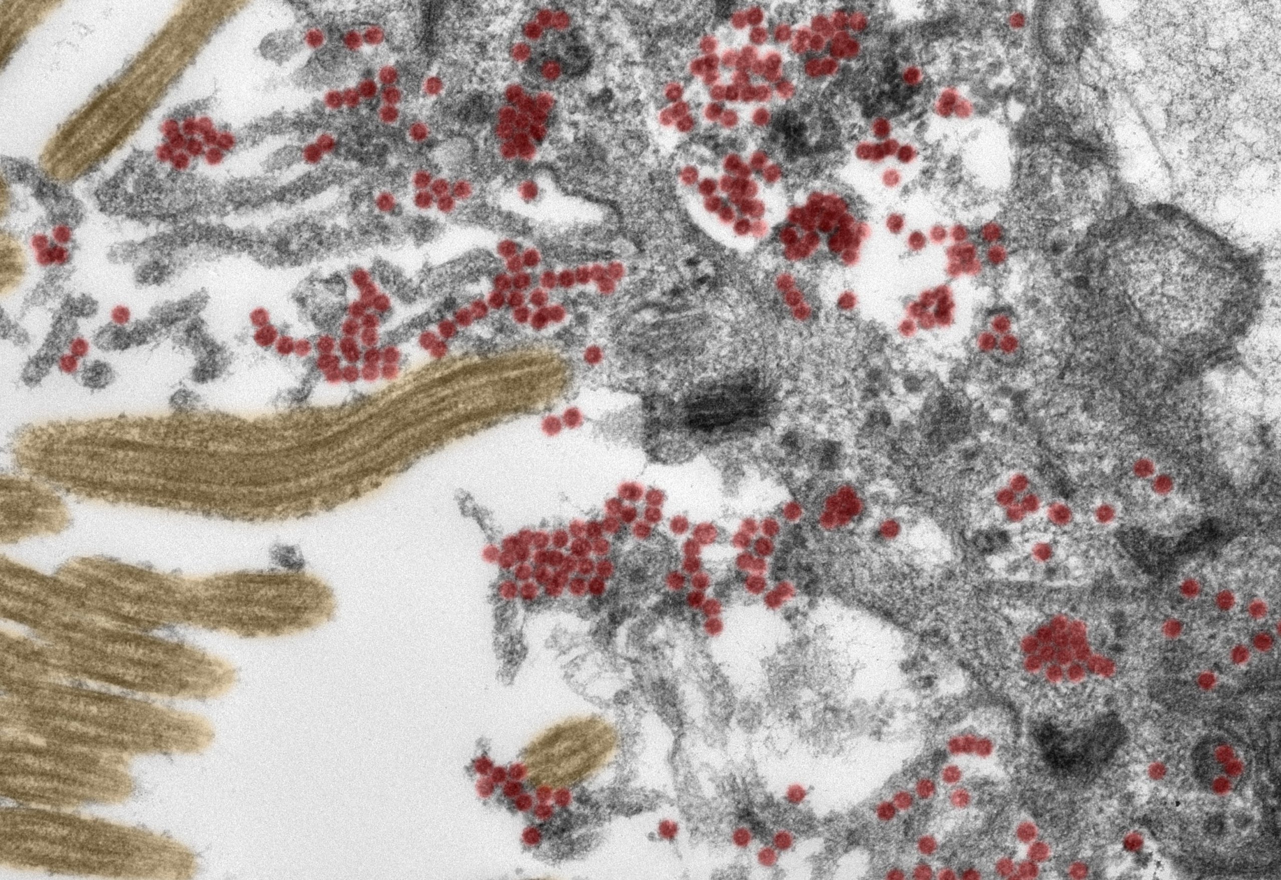 COVID-19, con quali meccanismi il coronavirus raggiunge il cervello? Pubblicazione scientifica dell'Università Charité di Berlino su Nature Neuroscience