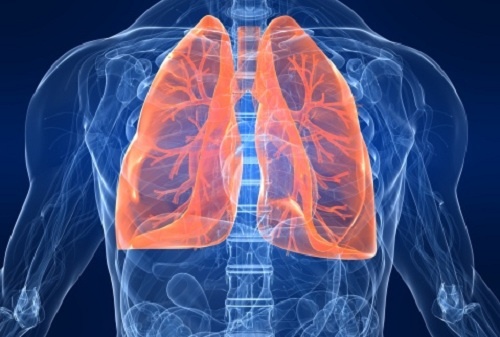 Pleurite, come individuare cause e sintomi dell'infezione ai polmoni?