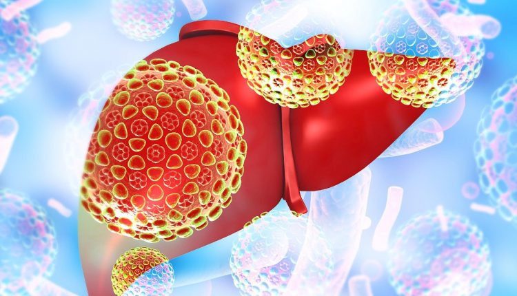 Epatite autoimmune: diagnosi, terapia e ricerca di questa patologia del fegato