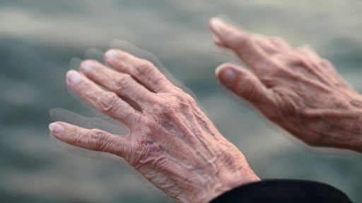 Parkinson, CNR Sapienza e Tor Vergata individuano nuovo potenziale biomarcatore