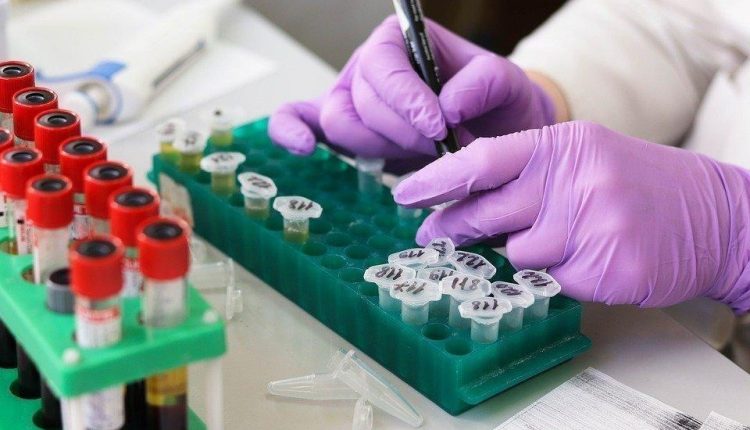 Polmonite da COVID-19, contro le forme più gravi trattamento con anakinra e metilprednisolone: lo studio del Policlinico di Milano