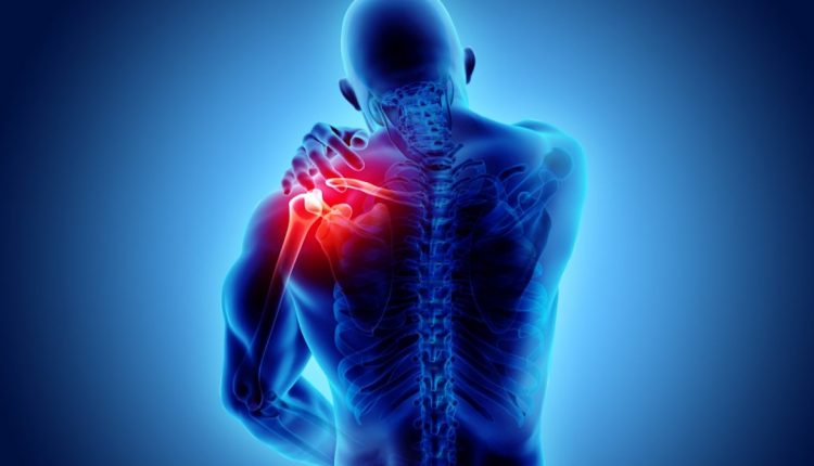 Sindrome da impingement: cause e trattamento dell'infiammazione alla spalla