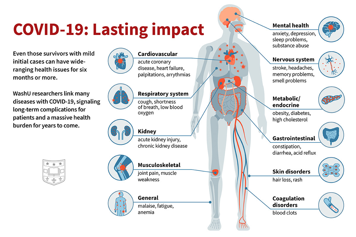 Long Covid, Washington University evidenzia conseguenze per i pazienti