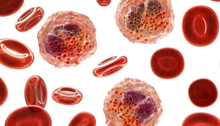 Malattie rare, EMA raccomanda estensione dell'indicazione per mepolizumab contro l' EGPA, raro disturbo infiammatorio auto-immune