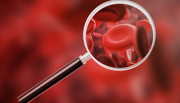 Anemia: che cos'è e quali problemi determina? - Emergency Live