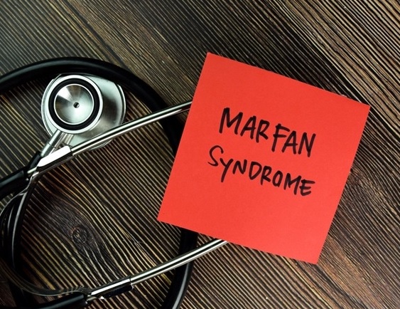 Sindrome Di Marfan Quando Si Manifesta
