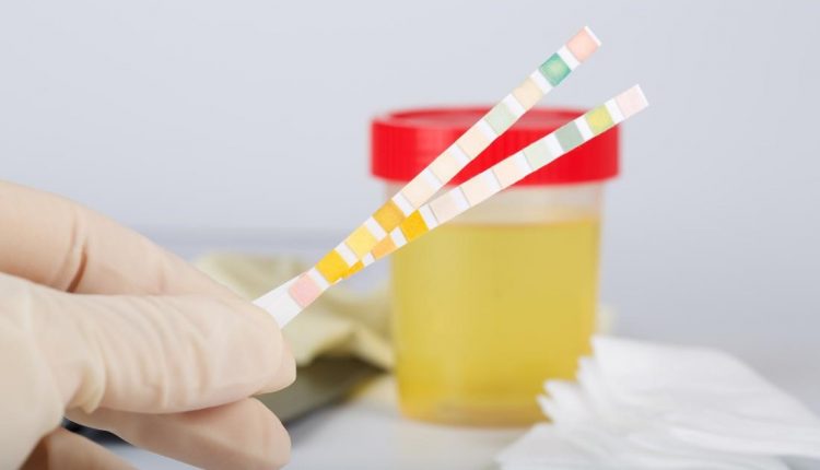 Perché ci sono leucociti nelle urine? Ecco cosa possono indicare
