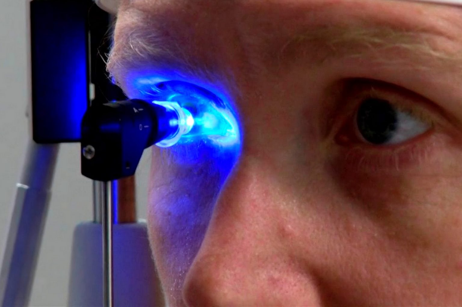 Come si misura la pressione oculare? Emergency Live Come si misura la pressione oculare? Emergency Live