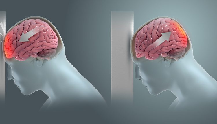 Emergency Live | The utility of advanced prehospital interventions for severe brain injury