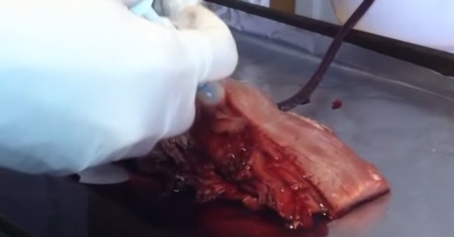 Emergency Live | Poly-STAT, the new gel that could stop a wound from bleeding
