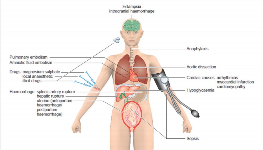 Sepsis nestumo metu