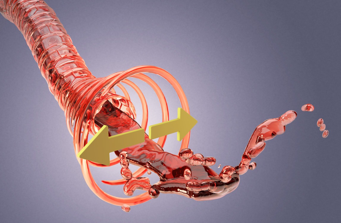 Emergency Live | Guidelines for the management of Arterial Hypertension