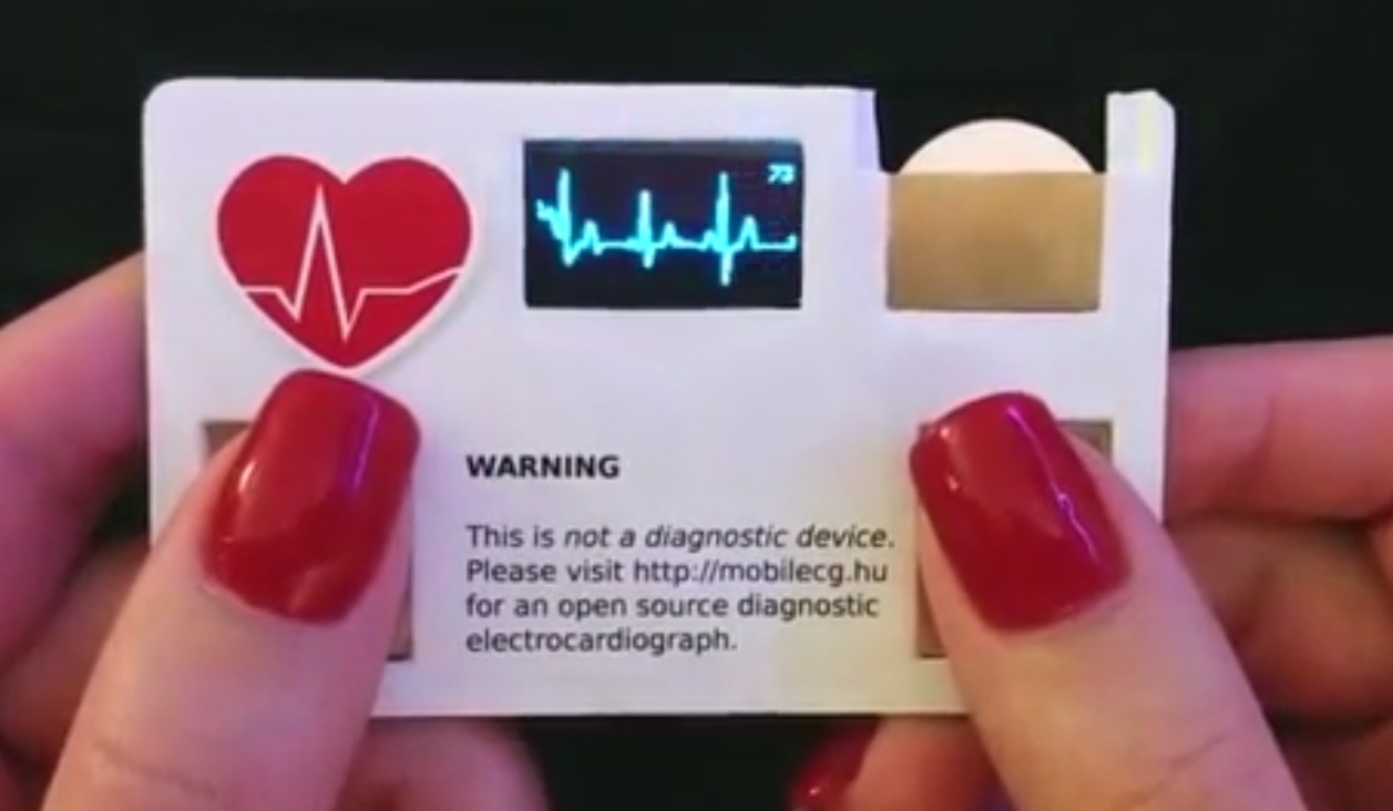 Emergency Live | Do you need an ECG test? This business ECG card do it now!